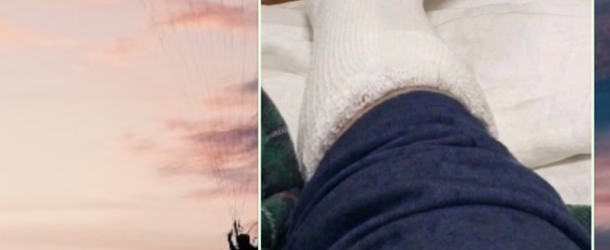 Fidanzato infortunato