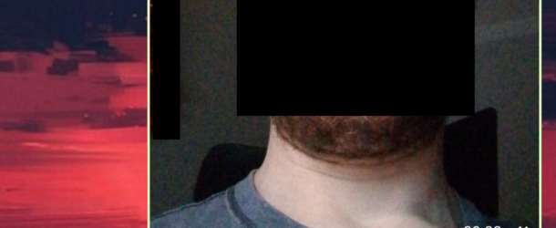 Il naso nuovo